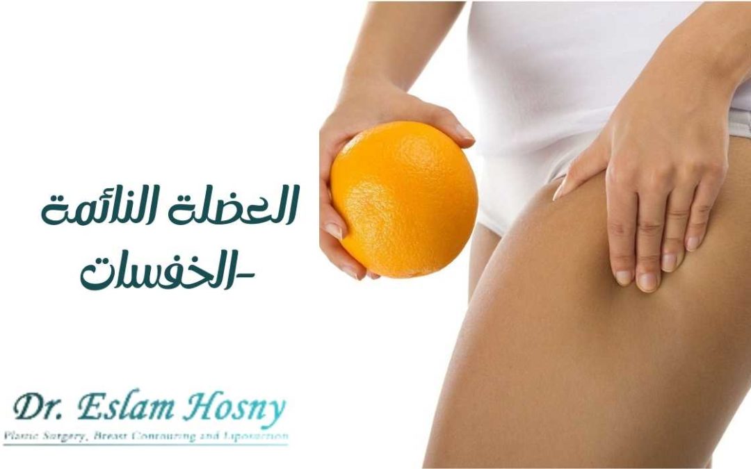 العضلة النائمة -الخفسات