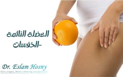 العضلة النائمة -الخفسات