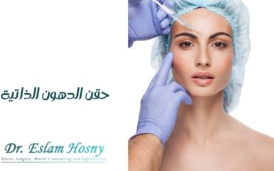 حقن الدهون الذاتية