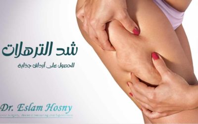 شفط الافخاذ ونحت الجسم