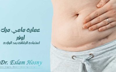 عملية مامي ميك اوفر