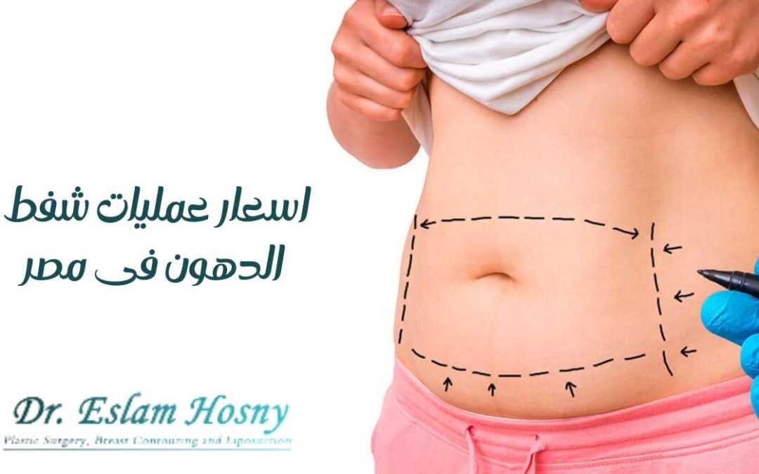 اسعار عمليات شفط الدهون في مصر
