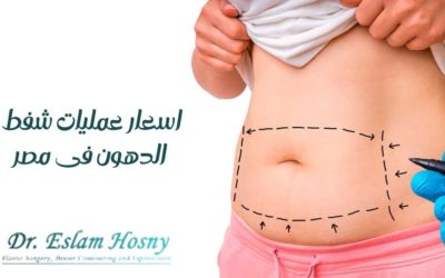 اسعار عمليات شفط الدهون في مصر