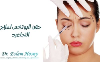 حقن البوتكس لعلاج التجاعيد
