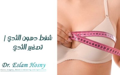 شفط دهون الثدي | تصغير الثدي