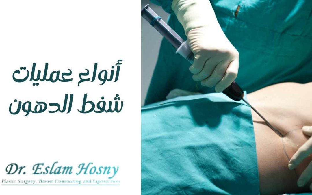 أنواع عمليات شفط الدهون