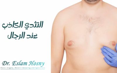 التثدي الكاذب عند الرجال