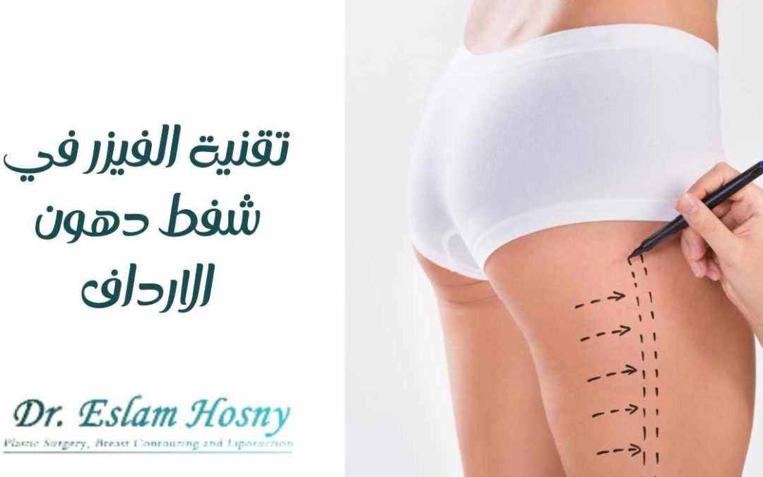 تقنية الفيزر في شفط دهون الارداف
