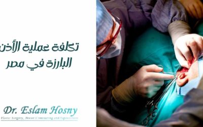تكلفة عملية الأذن البارزة في مصر