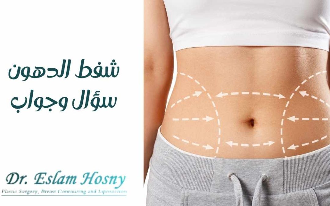 شفط الدهون سؤال وجواب