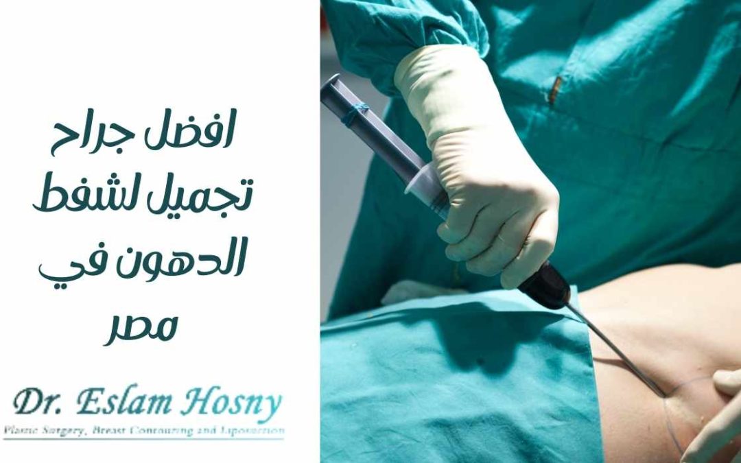 أفضل جراح تجميل لشفط الدهون في مصر