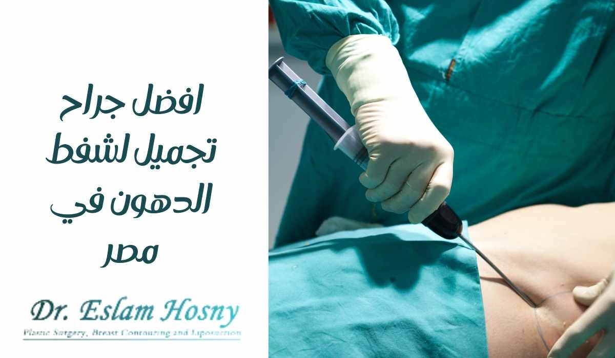 أفضل جراح تجميل لشفط الدهون في مصر