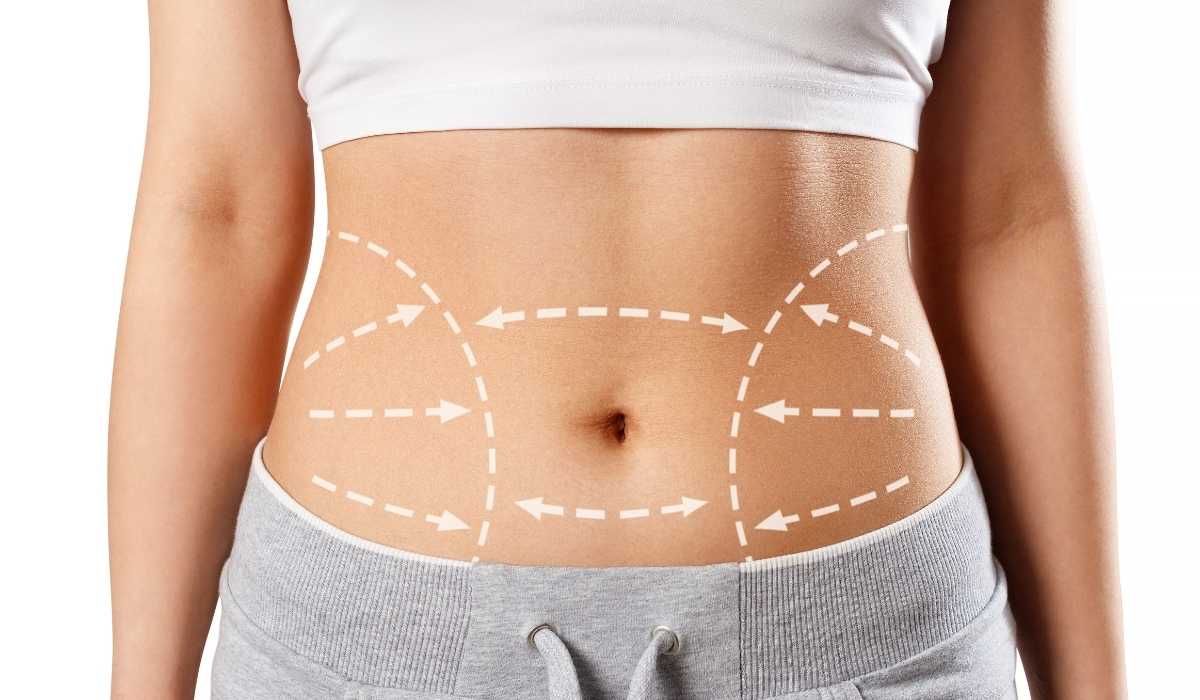 ٩ أسئلة عن عملية شفط الدهون 