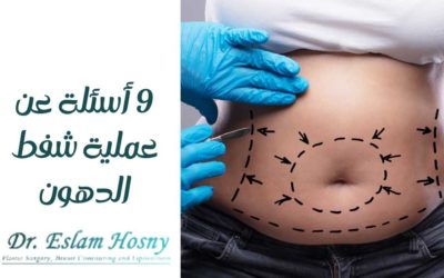 ٩ أسئلة عن عملية شفط الدهون