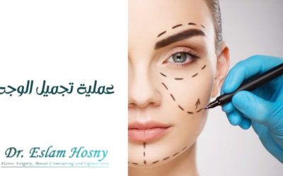 عملية تجميل الوجه