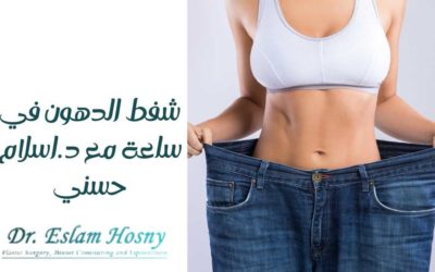 شفط الدهون في ساعة مع د. اسلام حسني