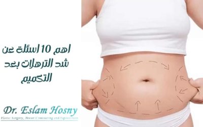 اهم 10 أسئلة عن شد الترهلات بعد التكميم