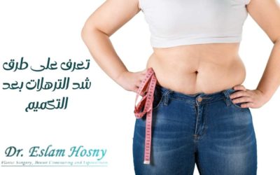 تعرف على طرق شد الترهلات بعد التكميم