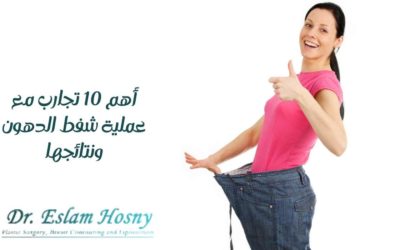 أهم 10 تجارب مع عملية شفط الدهون ونتائجها