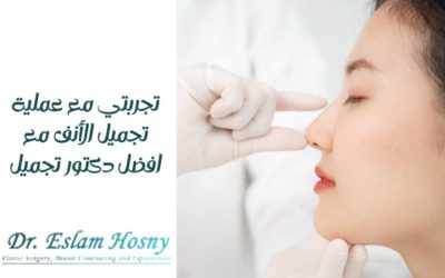 تجربتي مع عملية تجميل الأنف مع افضل دكتور تجميل