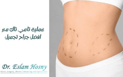 عملية تامي تاك مع افضل جراح تجميل