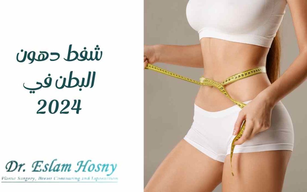 شفط دهون البطن في 2024