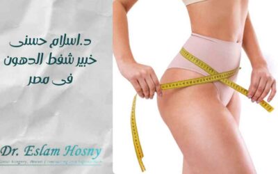 د.اسلام حسنى خبير شفط الدهون في مصر 