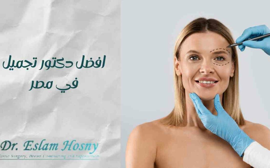 افضل دكتور تجميل في مصر