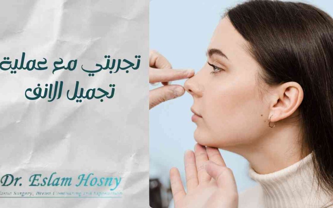 تجربتي مع عملية تجميل الانف