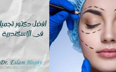 افضل دكتور تجميل فى الاسكندرية