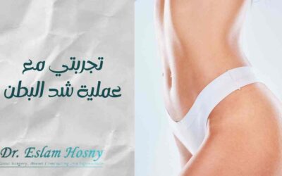 تجربتي مع عملية شد البطن