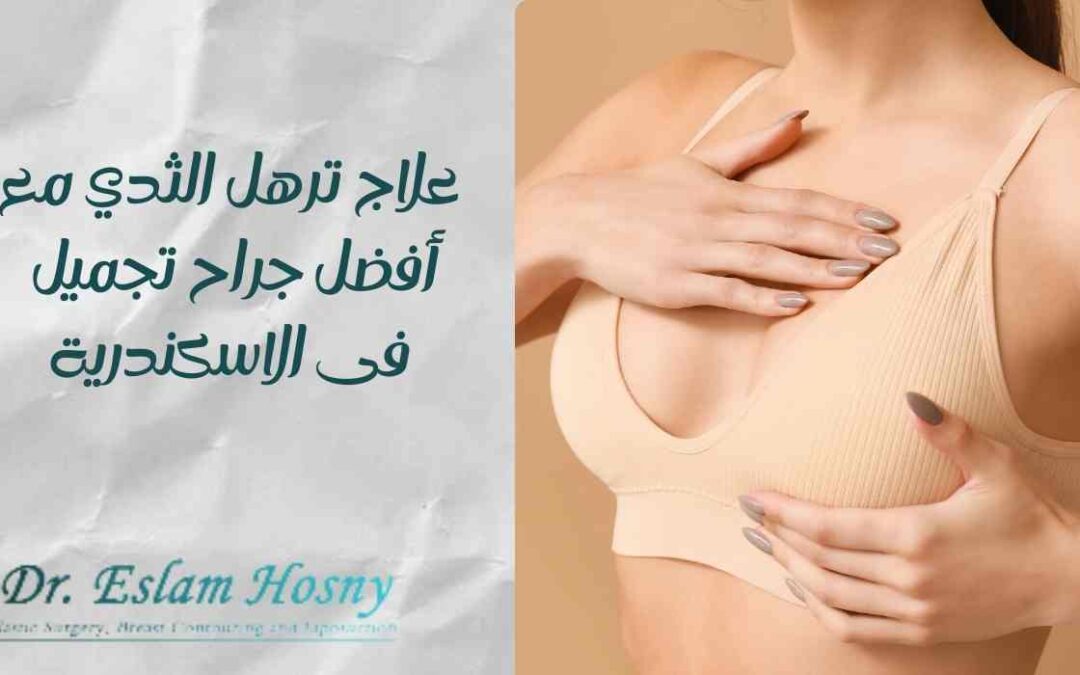 علاج ترهل الثدي مع أفضل جراح تجميل فى الاسكندرية