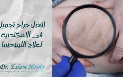 افضل جراح تجميل فى الاسكندرية لعلاج الليبوديما