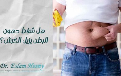 هل شفط دهون البطن يزيل الكرش؟