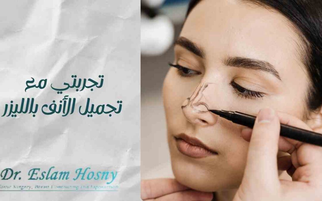 تجربتي مع تجميل الأنف بالليزر