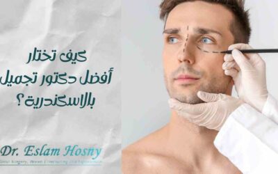 كيف تختار أفضل دكتور تجميل بالاسكندرية؟