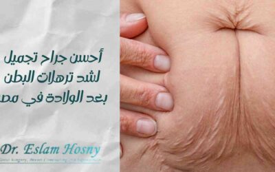 أحسن جراح تجميل شد ترهلات البطن بعد الولادة في مصر