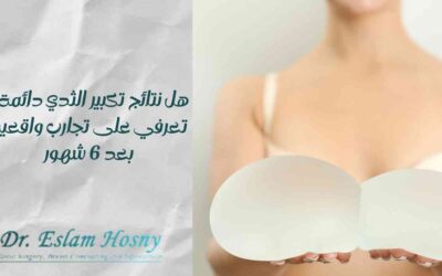 هل نتائج تكبير الثدي دائمة؟ تعرفي على تجارب واقعية بعد 6 شهور