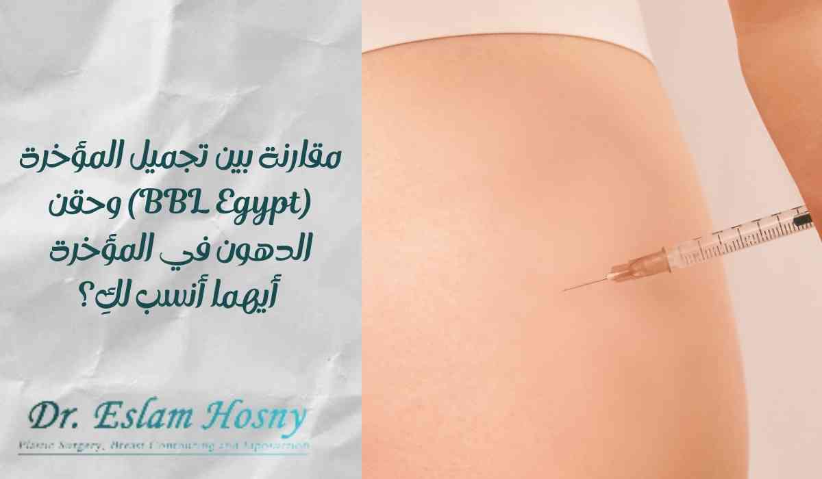 تجميل-المؤخرة-(bbl-egypt)