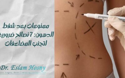 ممنوعات بعد شفط الدهون: 7 نصائح ضرورية لتجنب المضاعفات