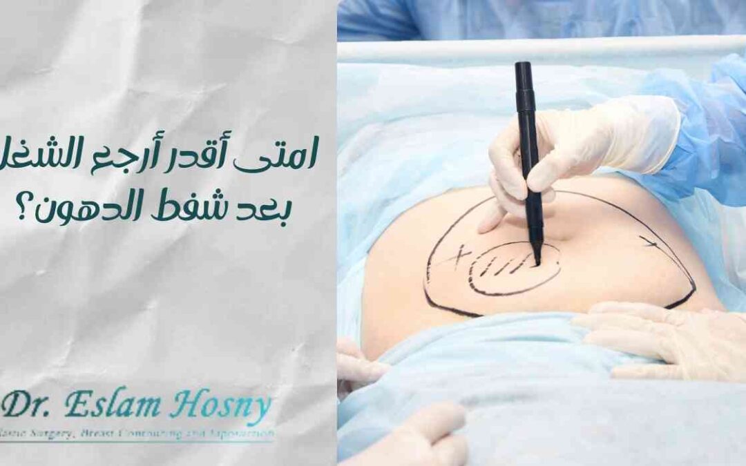 امتى أقدر أرجع الشغل بعد شفط الدهون؟