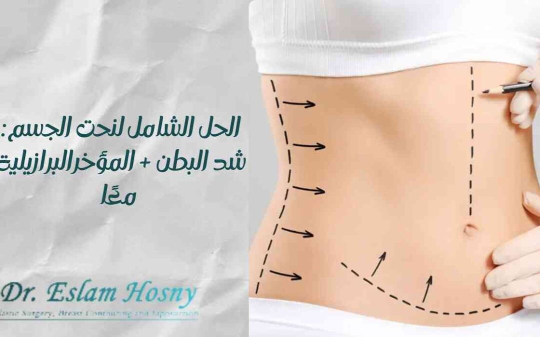 الحل الشامل لنحت الجسم: شد البطن + المؤخرة البرازيلية معًا