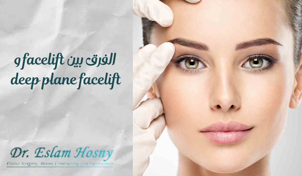 deep-plane-facelift