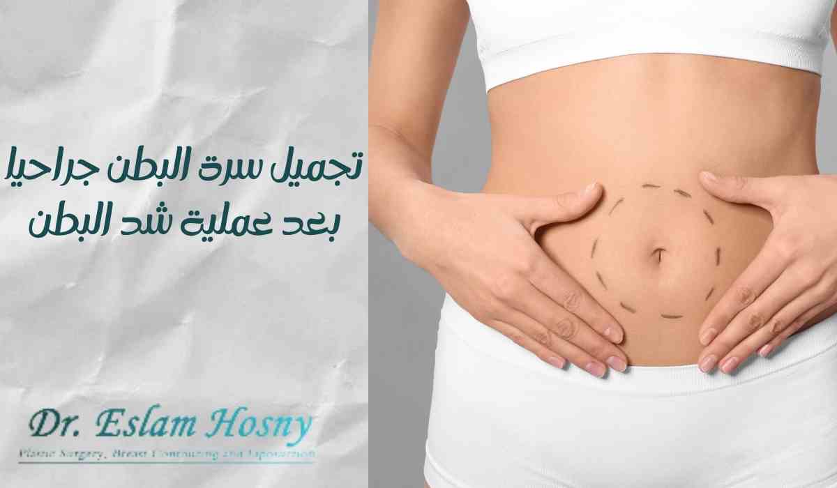 تجميل-سرة-البطن-جراحيا (1) تجميل-سرة-البطن-جراحيا
