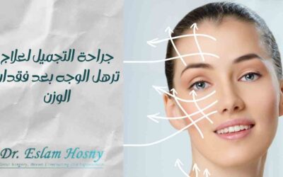 جراحة التجميل لعلاج ترهل الوجه بعد فقدان الوزن