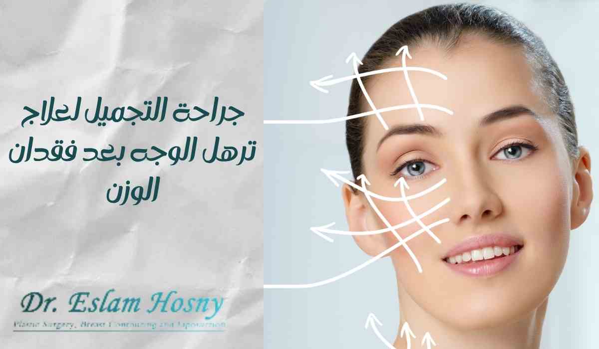 جراحة-التجميل-لعلاج-ترهل-الوجه-بعد-فقدان-الوزن (1) جراحة-التجميل-لعلاج-ترهل-الوجه-بعد-فقدان-الوزن