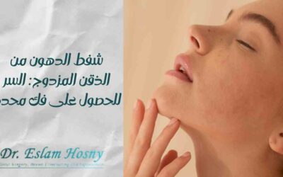 شفط الدهون من الذقن المزدوج: السر للحصول على فك محدد