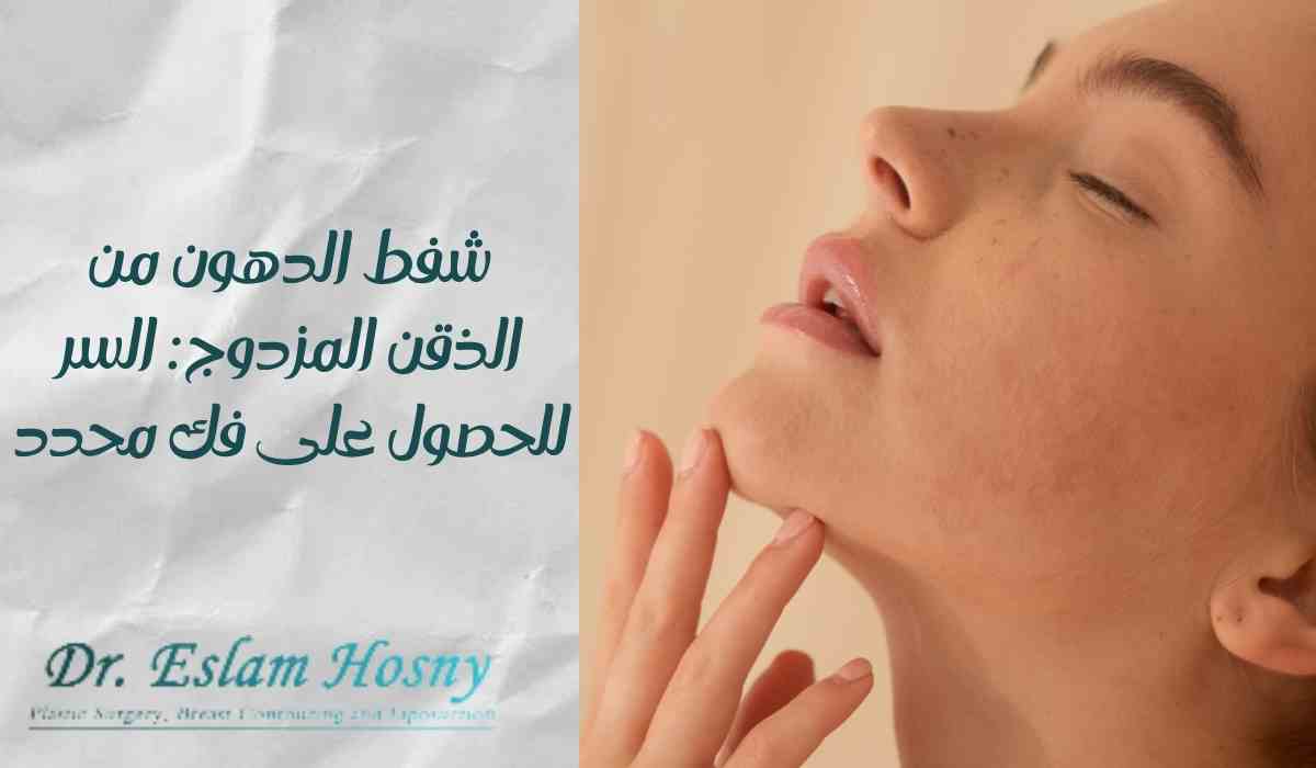 شفط-الدهون-من-الذقن-المزدوج (1) شفط-الدهون-من-الذقن-المزدوج