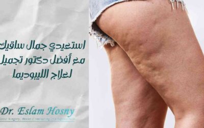 استعيدي جمال ساقيك مع أفضل دكتور تجميل لعلاج الليبوديما