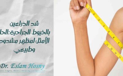 شد الذراعين بالخيوط الجراحية:الحل الأمثل لمظهر مشدود وطبيعي